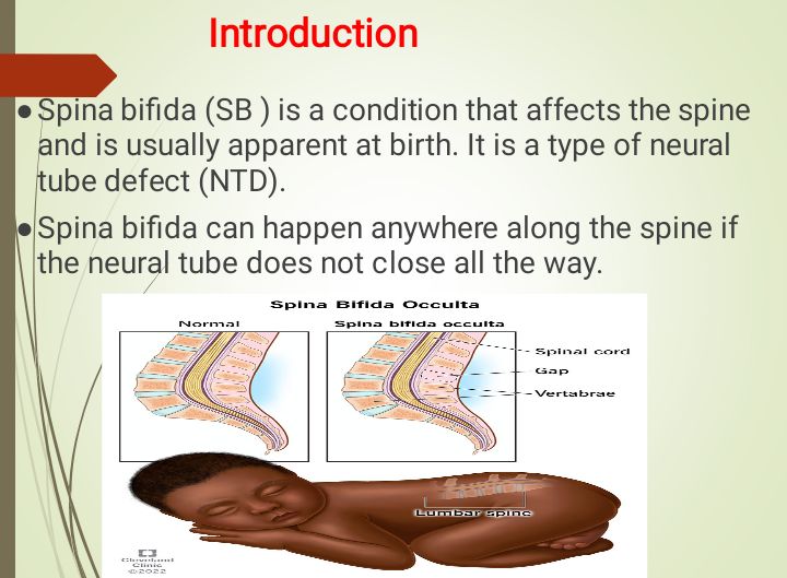 No preview available